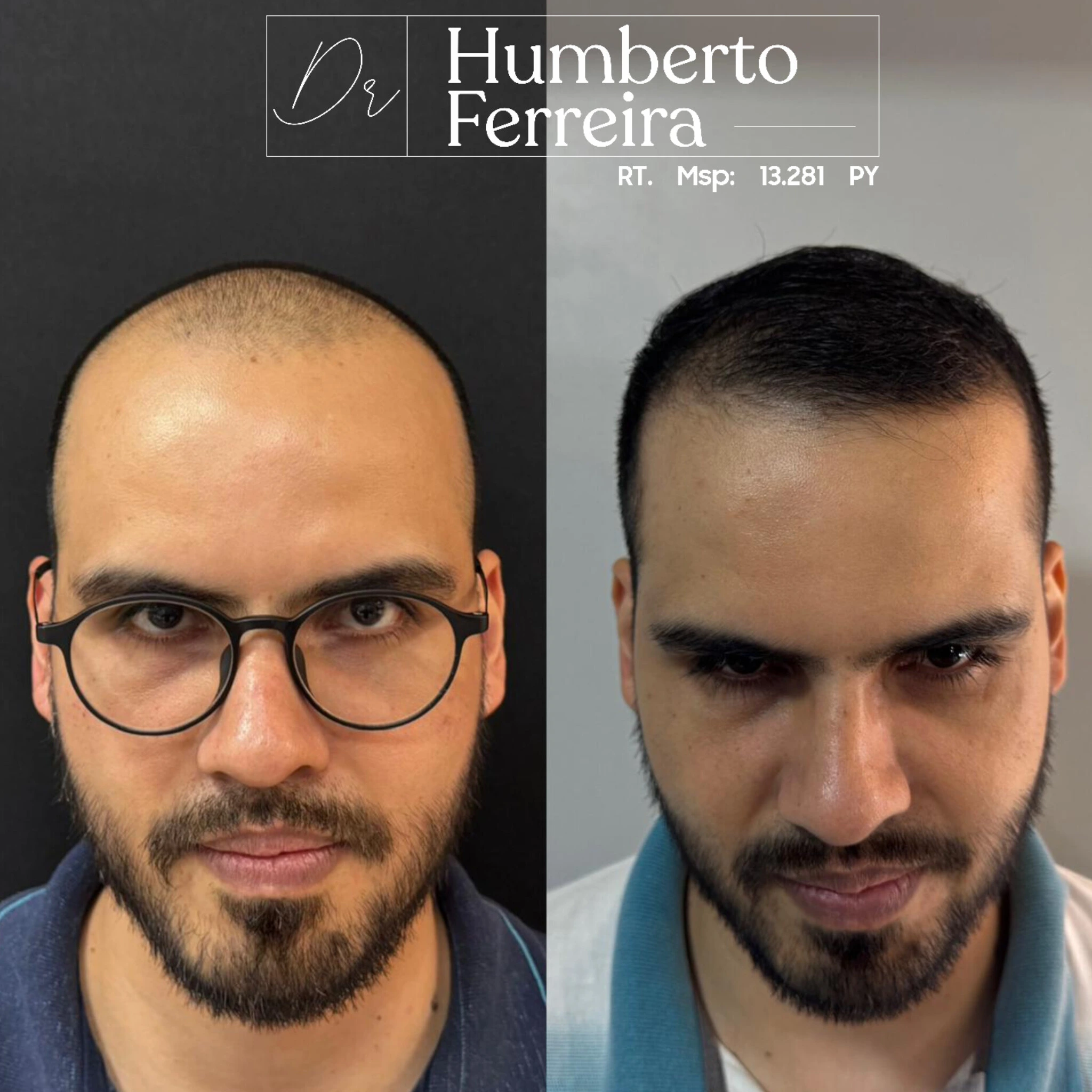 Resultado de paciente 7: Antes y Después