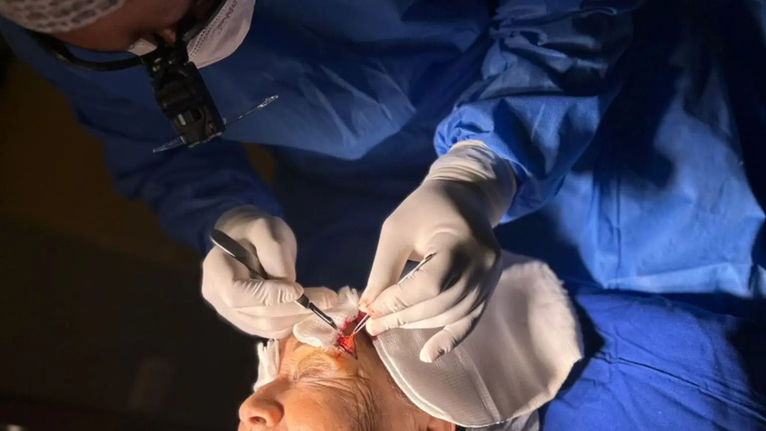 Cirugía Estética Facial